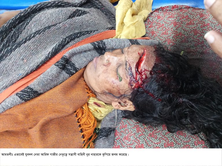 আমতলীতে ধান কাটতে বাঁধা দেয়ায় চার নারীসহ পাঁচজনকে কুপিয়ে জখম