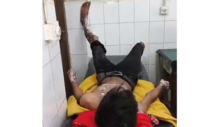 সরিষাবাড়ীতে আগুনে দগ্ধ তিন যুবক