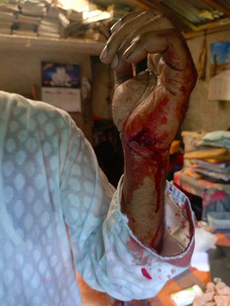 শিক্ষকের হামলায় গুরুতর জখম অপর শিক্ষক হাসপাতালে